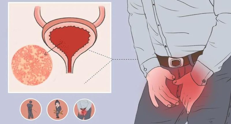 喷剂一用就辣，是过敏还是正常？很多人没分清