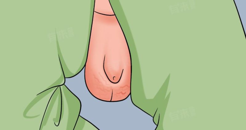 低头一瞄丁丁变小了？别慌！分清“真假缩水”！