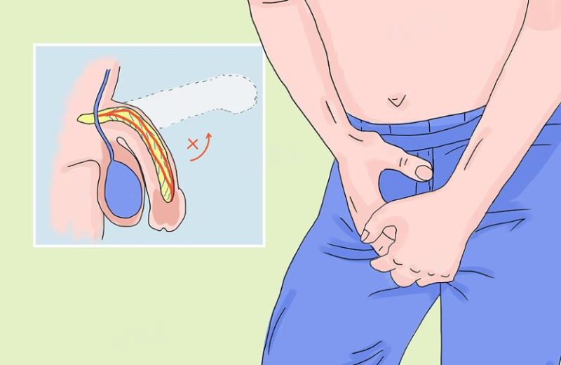 50岁男人的“性”福危机：如何做到完全站直？