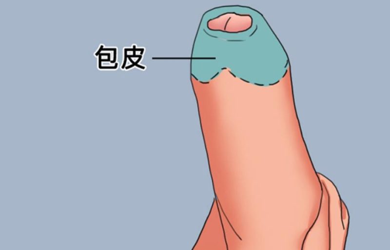 时间短跟包皮长有关吗？