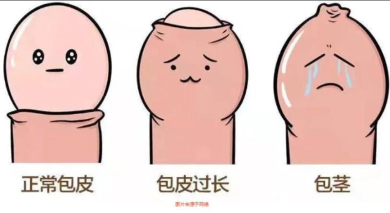 时间短跟包皮长有关吗? 文章配图 图片第2张 - 九爷评测